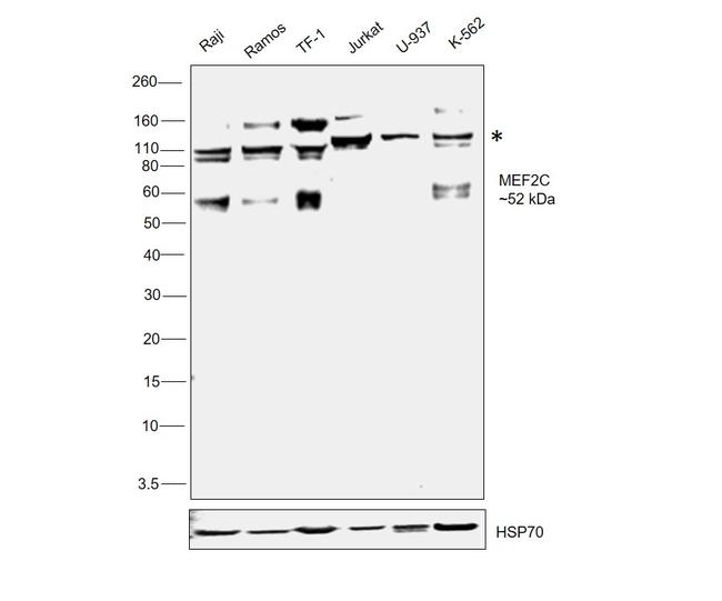 MEF2C Antibody in Western Blot (WB)