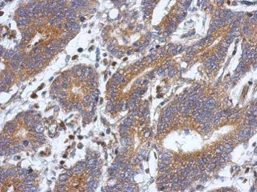 ATXN10 Antibody in Immunohistochemistry (Paraffin) (IHC (P))