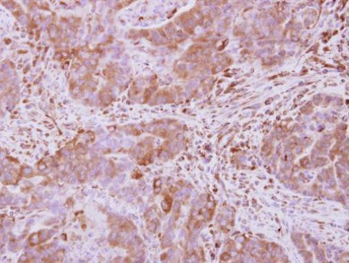 Optineurin Antibody in Immunohistochemistry (Paraffin) (IHC (P))