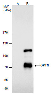 Optineurin Antibody in Immunoprecipitation (IP)