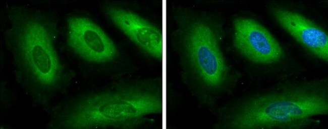 GSPT1 Antibody in Immunocytochemistry (ICC/IF)