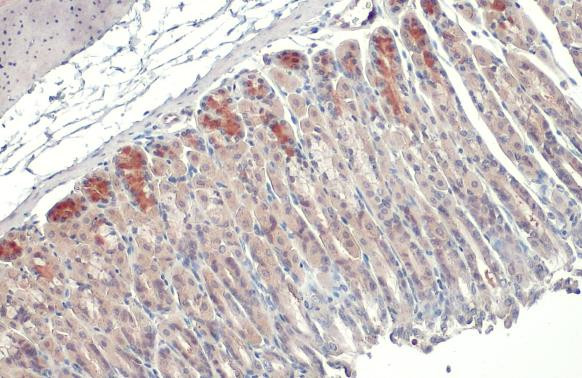 GSPT1 Antibody in Immunohistochemistry (Paraffin) (IHC (P))