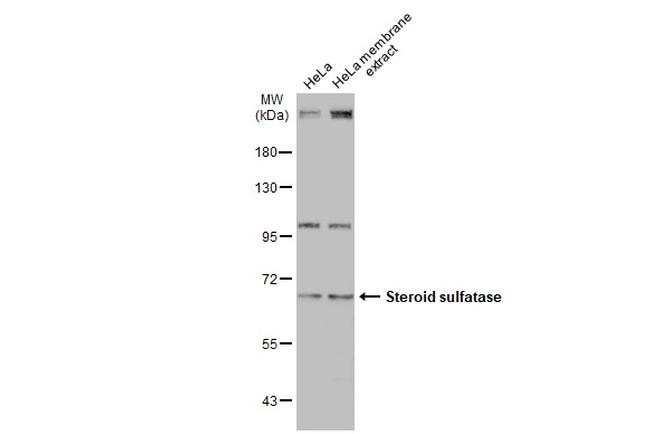 STS Antibody in Western Blot (WB)