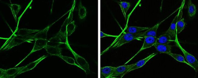 NAGLU Antibody in Immunocytochemistry (ICC/IF)