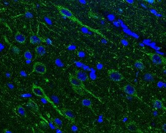 NAGLU Antibody in Immunohistochemistry (Paraffin) (IHC (P))