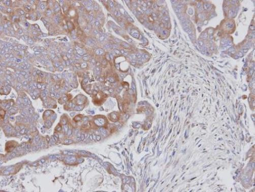 JNK2 Antibody in Immunohistochemistry (Paraffin) (IHC (P))