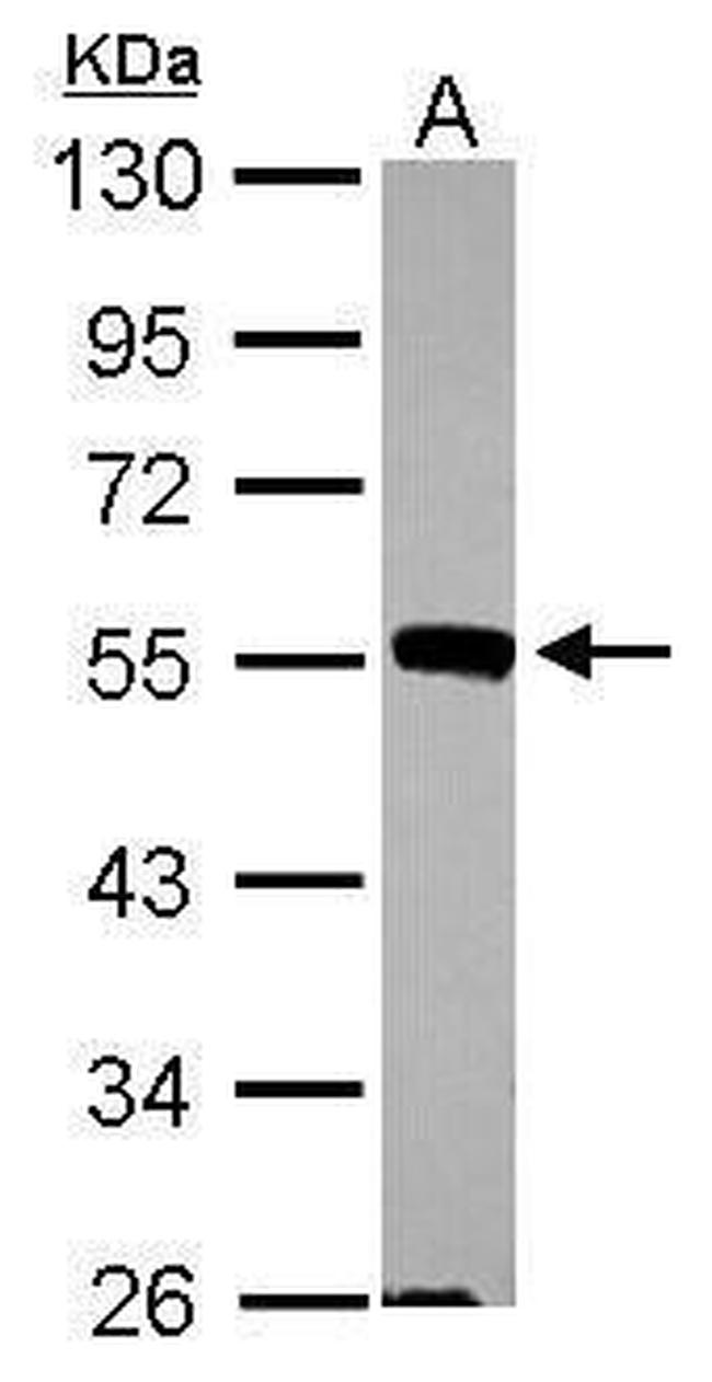 JNK2 Antibody in Western Blot (WB)