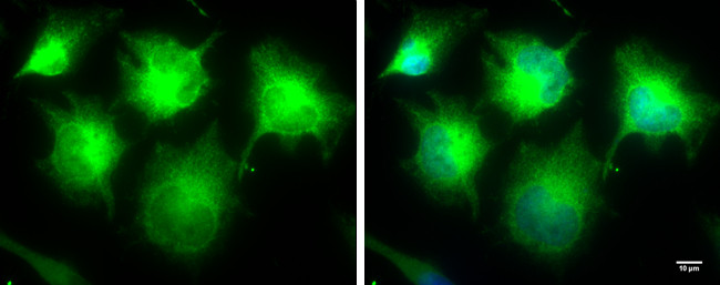 IKK epsilon Antibody in Immunocytochemistry (ICC/IF)