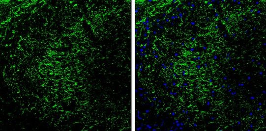 PRKAR2B Antibody in Immunohistochemistry (Frozen) (IHC (F))