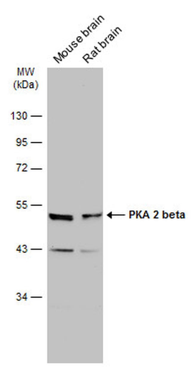 PRKAR2B Antibody in Western Blot (WB)