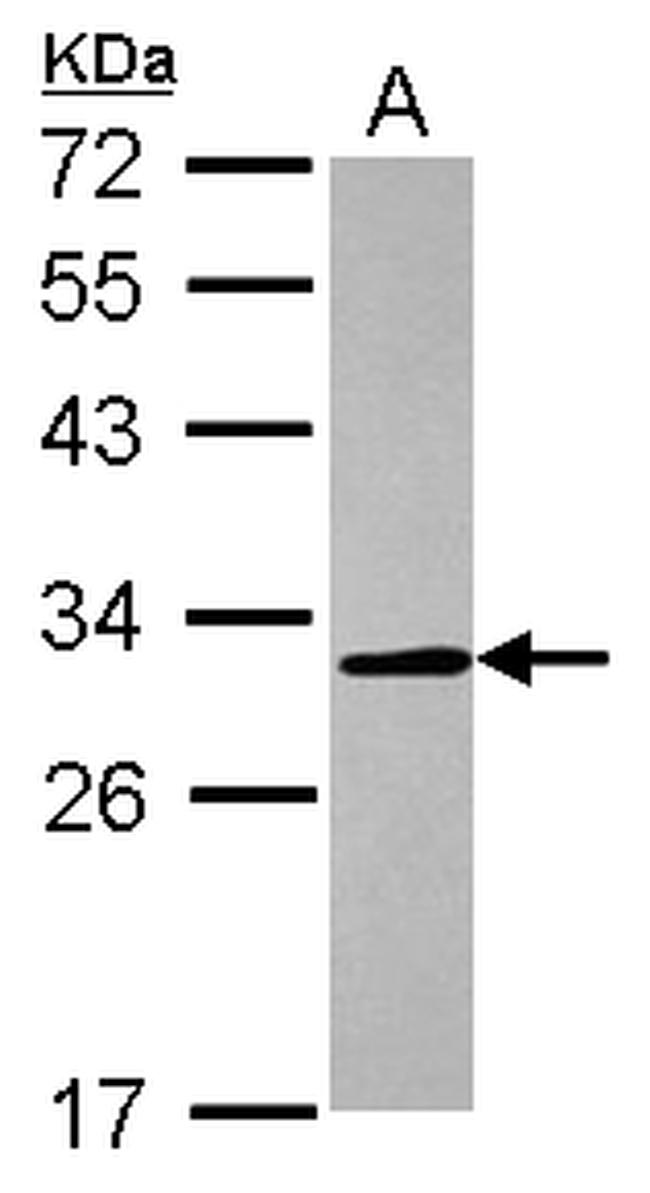 Carbonic Anhydrase II Antibody in Western Blot (WB)