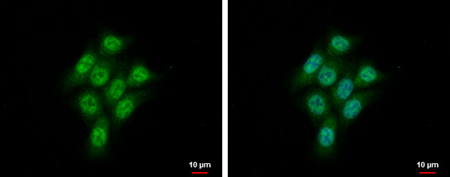 CMPK1 Antibody in Immunocytochemistry (ICC/IF)