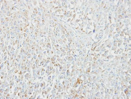 MIPEP Antibody in Immunohistochemistry (Paraffin) (IHC (P))