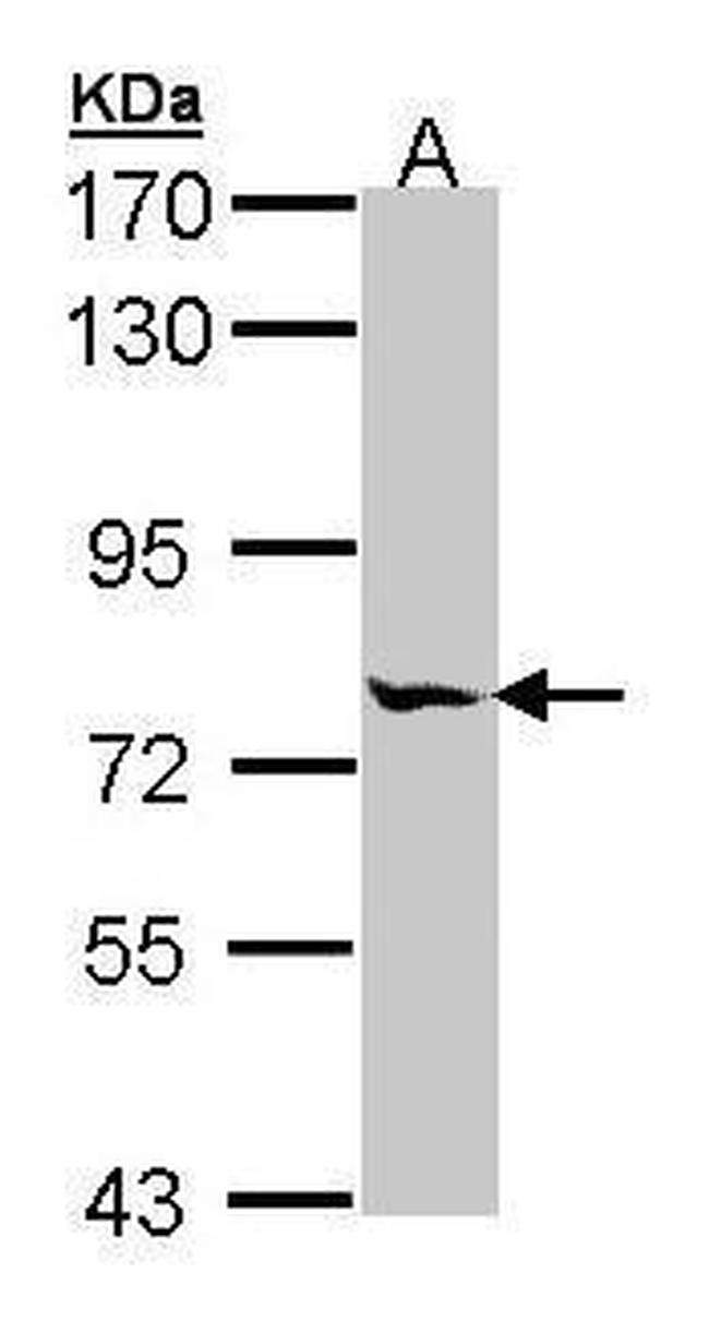 MIPEP Antibody in Western Blot (WB)