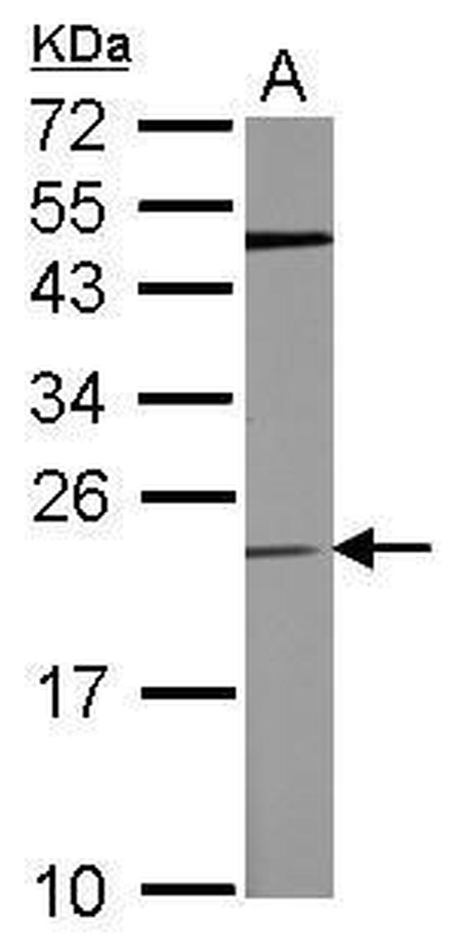 TPT1 Antibody in Western Blot (WB)