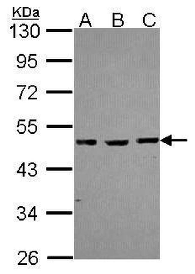 MBD2 Antibody in Western Blot (WB)