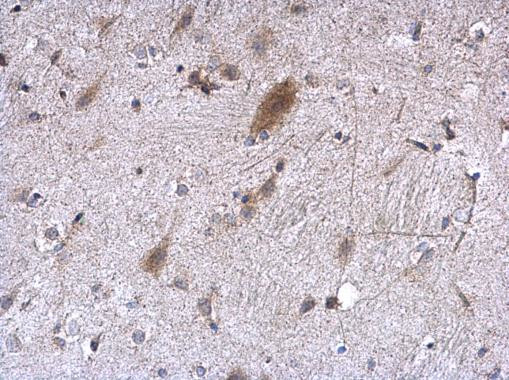 EEF1E1 Antibody in Immunohistochemistry (Paraffin) (IHC (P))