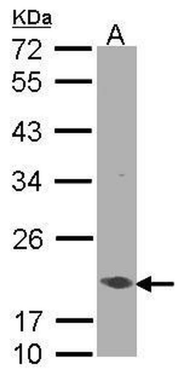 EEF1E1 Antibody in Western Blot (WB)