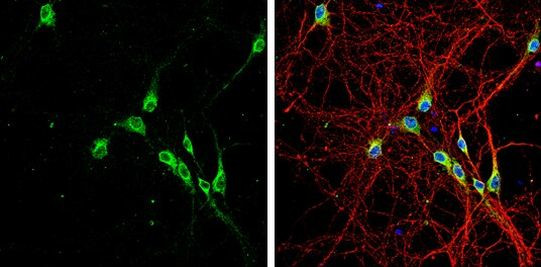 LGI1 Antibody in Immunocytochemistry (ICC/IF)