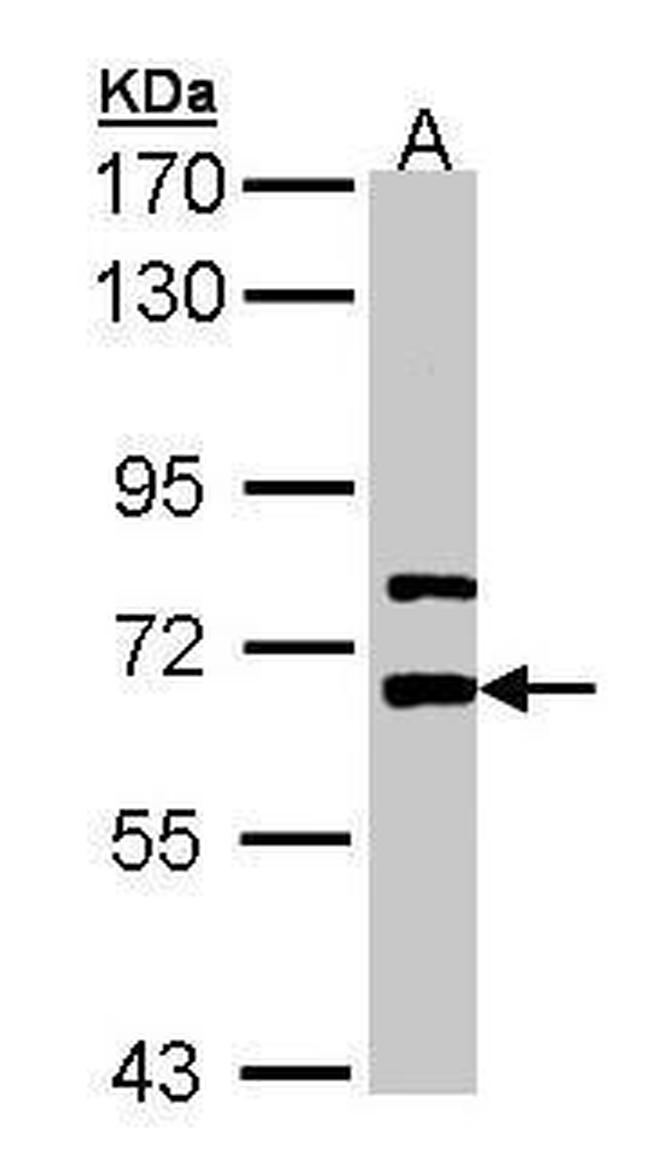 LGI1 Antibody in Western Blot (WB)