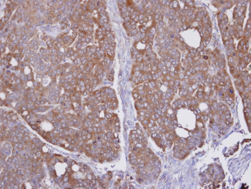 HAGH Antibody in Immunohistochemistry (Paraffin) (IHC (P))