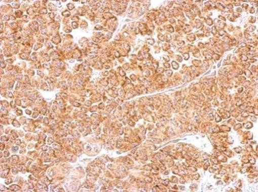 DR3 Antibody in Immunohistochemistry (Paraffin) (IHC (P))