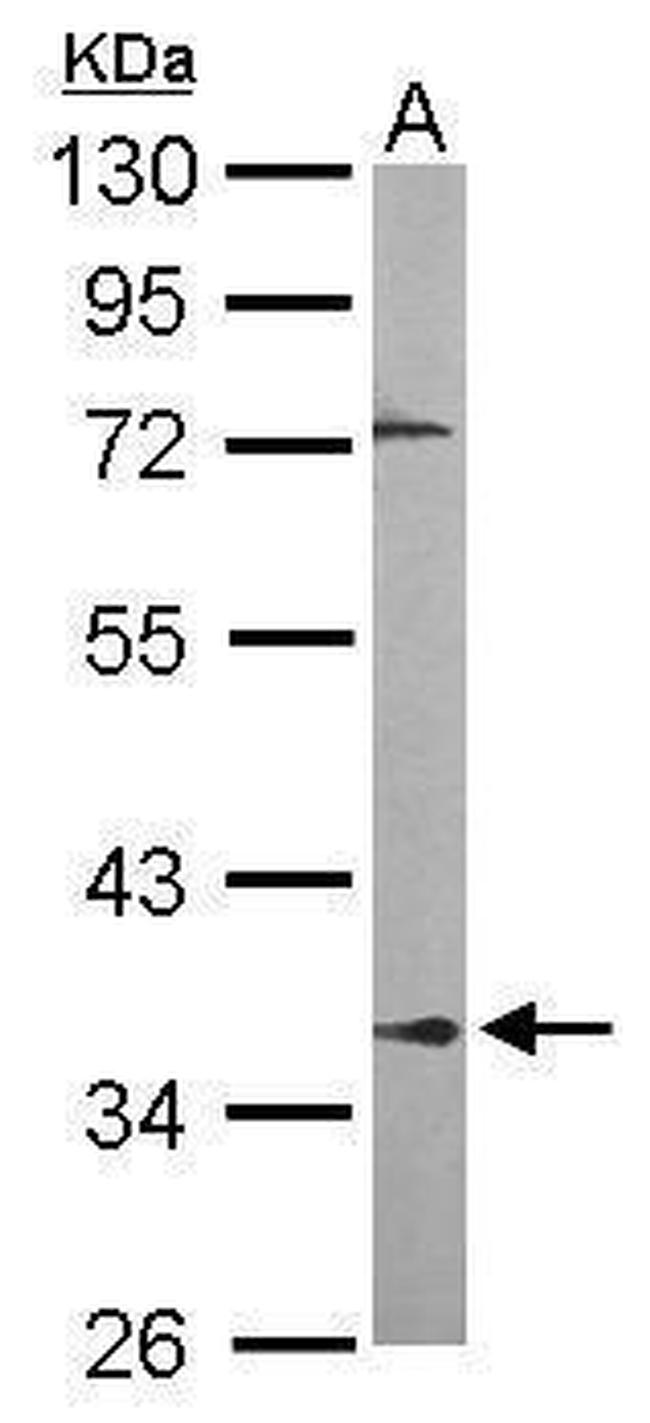 PPP2R4 Antibody in Western Blot (WB)