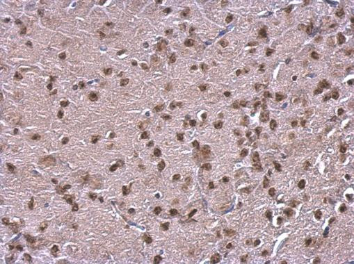 NFIB Antibody in Immunohistochemistry (Paraffin) (IHC (P))