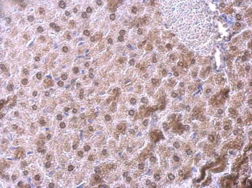 NFIB Antibody in Immunohistochemistry (Paraffin) (IHC (P))