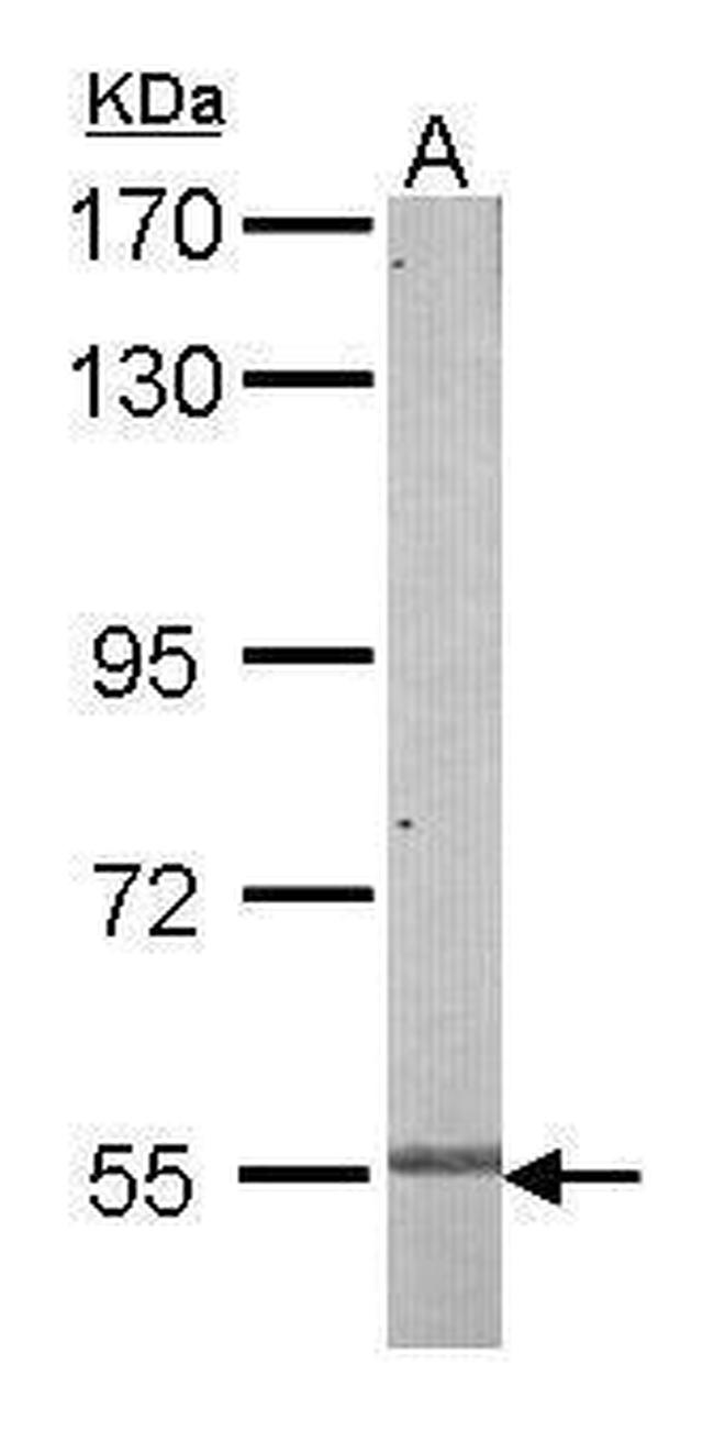 NFIB Antibody in Western Blot (WB)