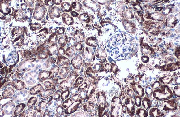 GluD1 Antibody in Immunohistochemistry (Paraffin) (IHC (P))