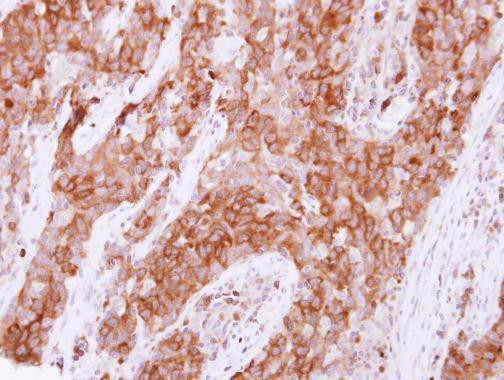 PTPN14 Antibody in Immunohistochemistry (Paraffin) (IHC (P))