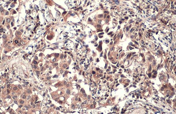 PTPN14 Antibody in Immunohistochemistry (Paraffin) (IHC (P))