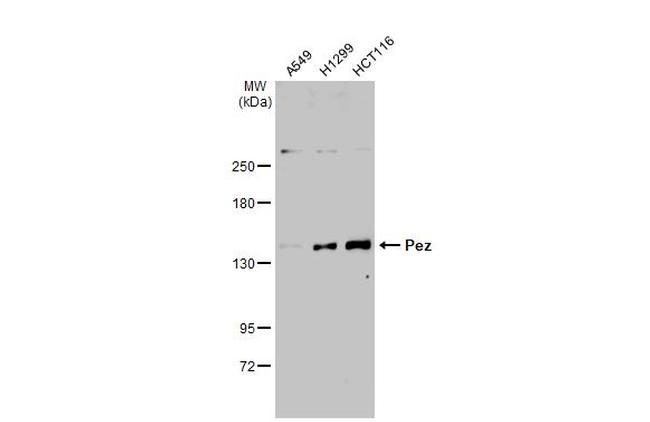 PTPN14 Antibody in Western Blot (WB)