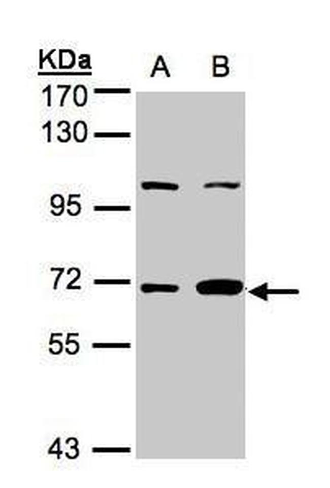 GBP1 Antibody in Western Blot (WB)