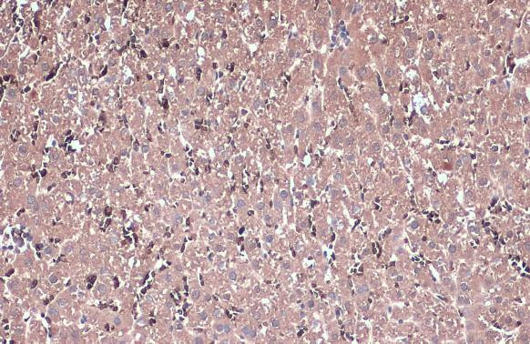 IL13RA1 Antibody in Immunohistochemistry (Paraffin) (IHC (P))