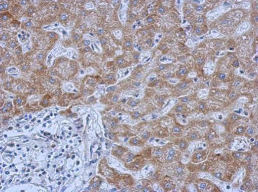 IL13RA1 Antibody in Immunohistochemistry (Paraffin) (IHC (P))