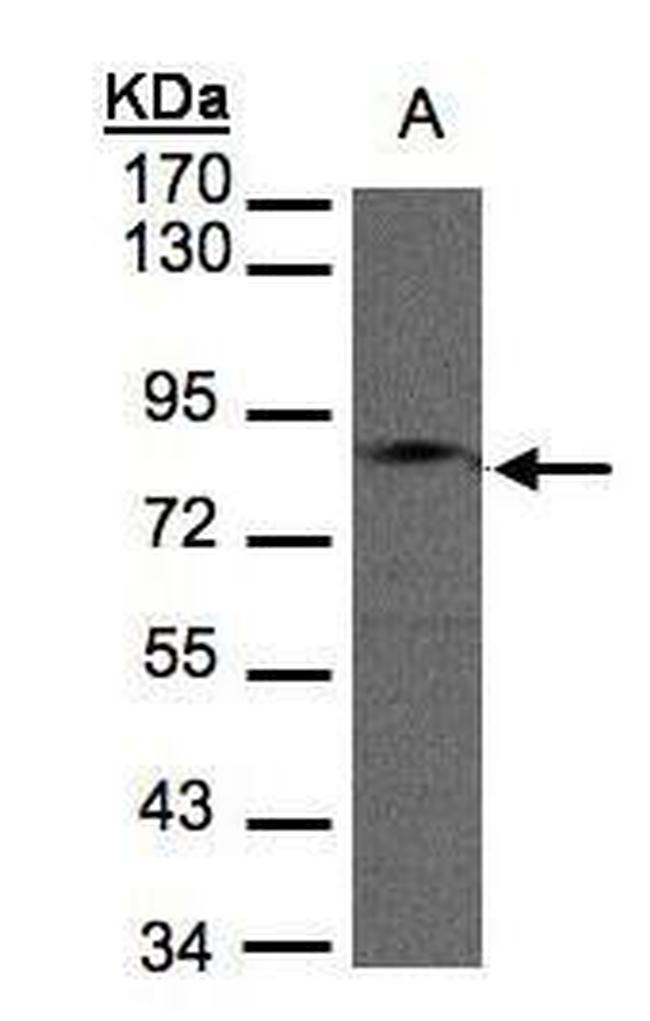 GIT1 Antibody in Western Blot (WB)