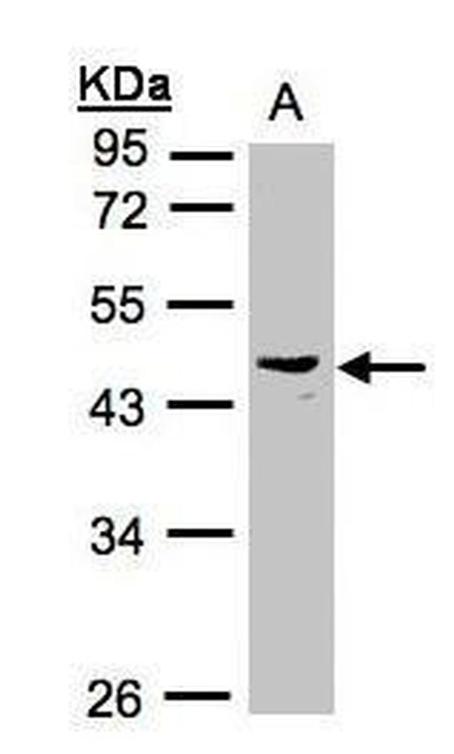 PSG6 Antibody in Western Blot (WB)