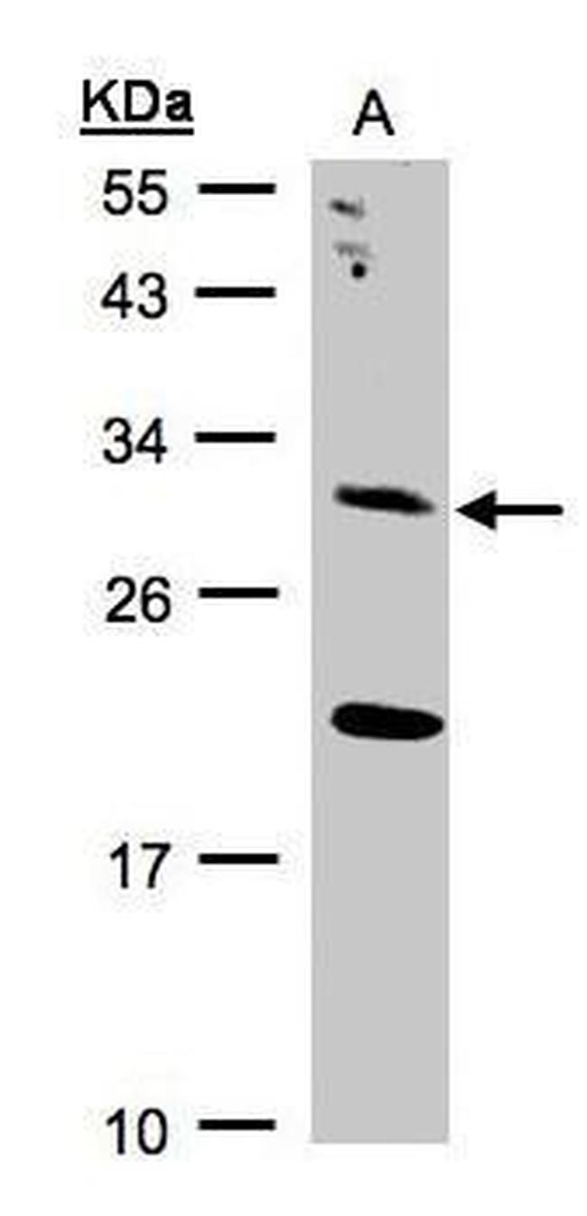 UROS Antibody in Western Blot (WB)