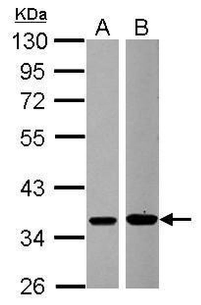 MEK6 Antibody in Western Blot (WB)