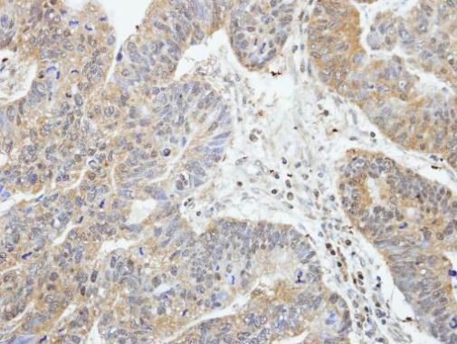 RIP2 Antibody in Immunohistochemistry (Paraffin) (IHC (P))