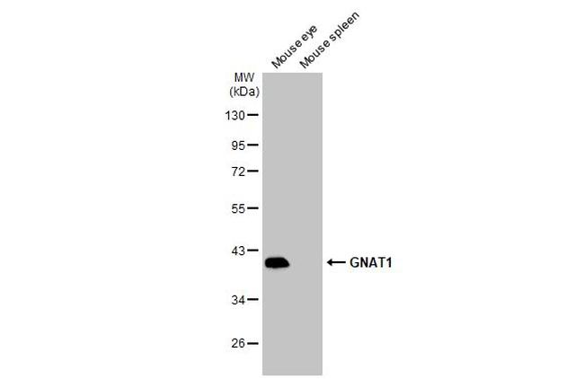 GNAT1 Antibody in Western Blot (WB)