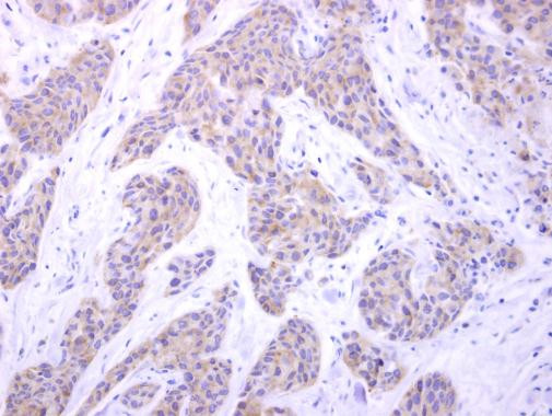 PIGK Antibody in Immunohistochemistry (Paraffin) (IHC (P))