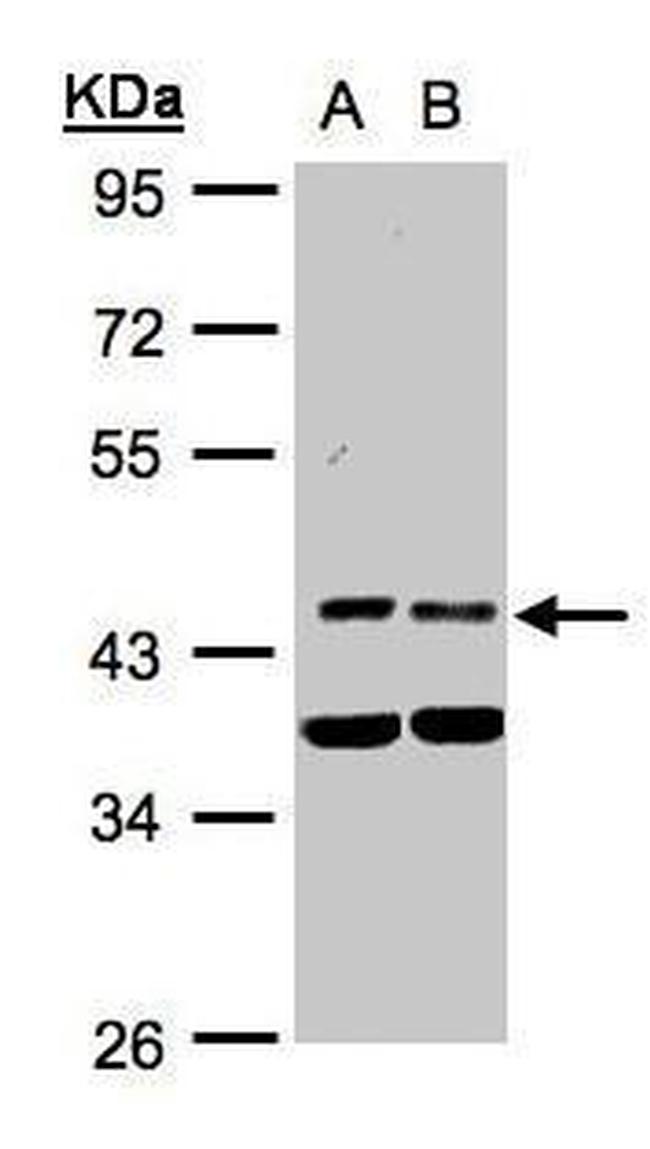 PDK1 Antibody in Western Blot (WB)