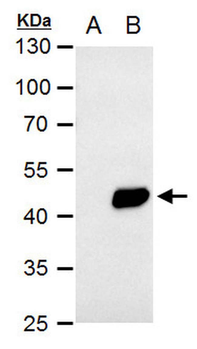 PDK1 Antibody in Western Blot (WB)