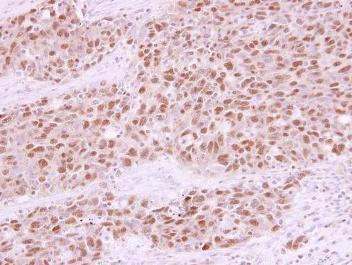 RAD21 Antibody in Immunohistochemistry (Paraffin) (IHC (P))