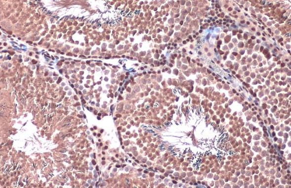 RAD21 Antibody in Immunohistochemistry (Paraffin) (IHC (P))