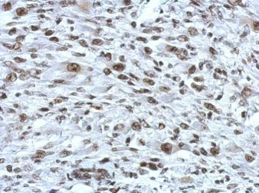 RAD21 Antibody in Immunohistochemistry (Paraffin) (IHC (P))