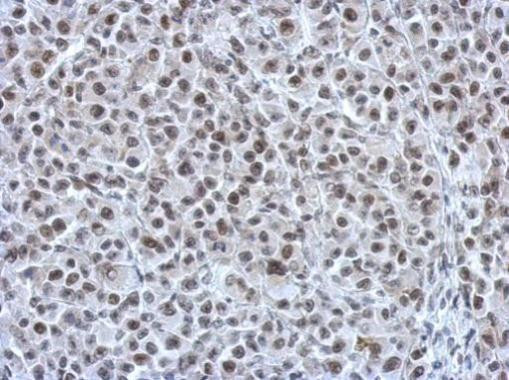 RAD21 Antibody in Immunohistochemistry (Paraffin) (IHC (P))